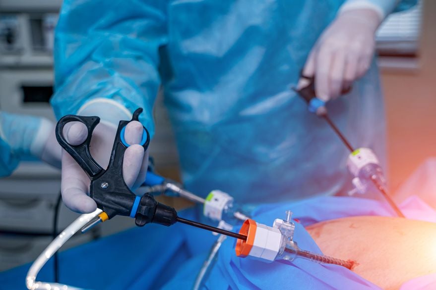Alertan sobre el riesgo de suspender las cirugías por obesidad por la segunda ola
