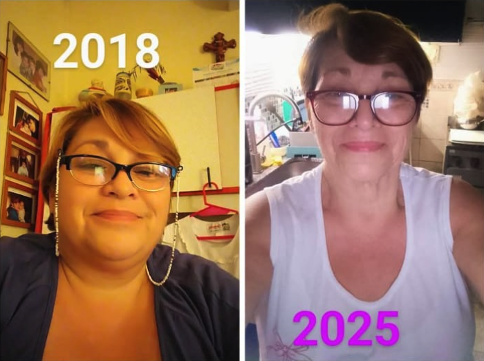 Autocuidado post cirugía bariátrica