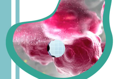 Cirugía bariátrica y prevención del cáncer: una conexión importante