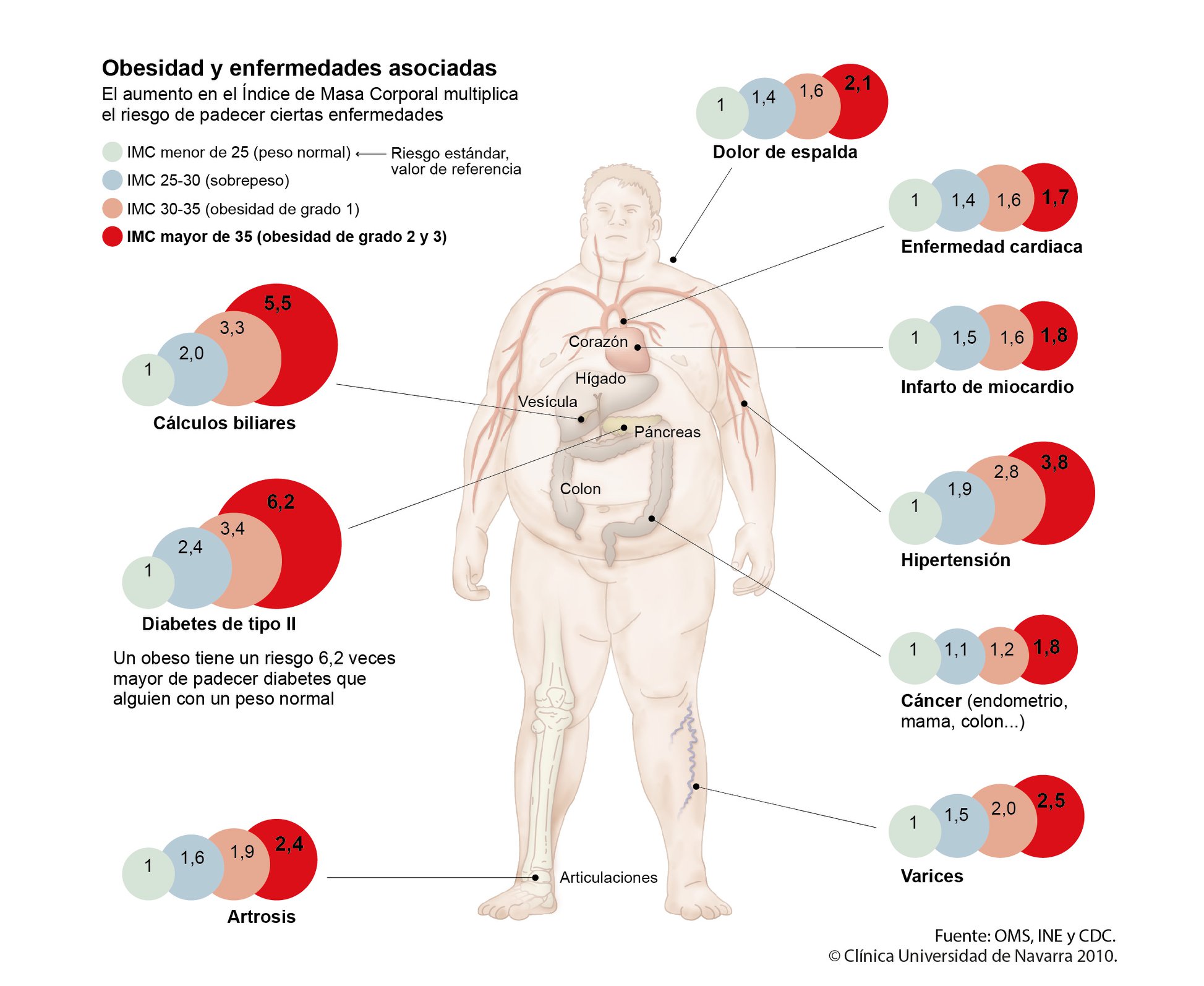 Bypass gástrico: Riesgos y beneficios