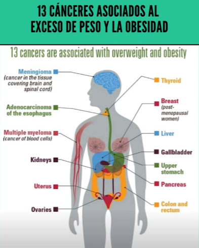 Cáncer y cirugía bariátrica