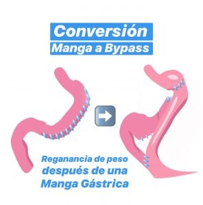 Cirugía de revisión y corrección