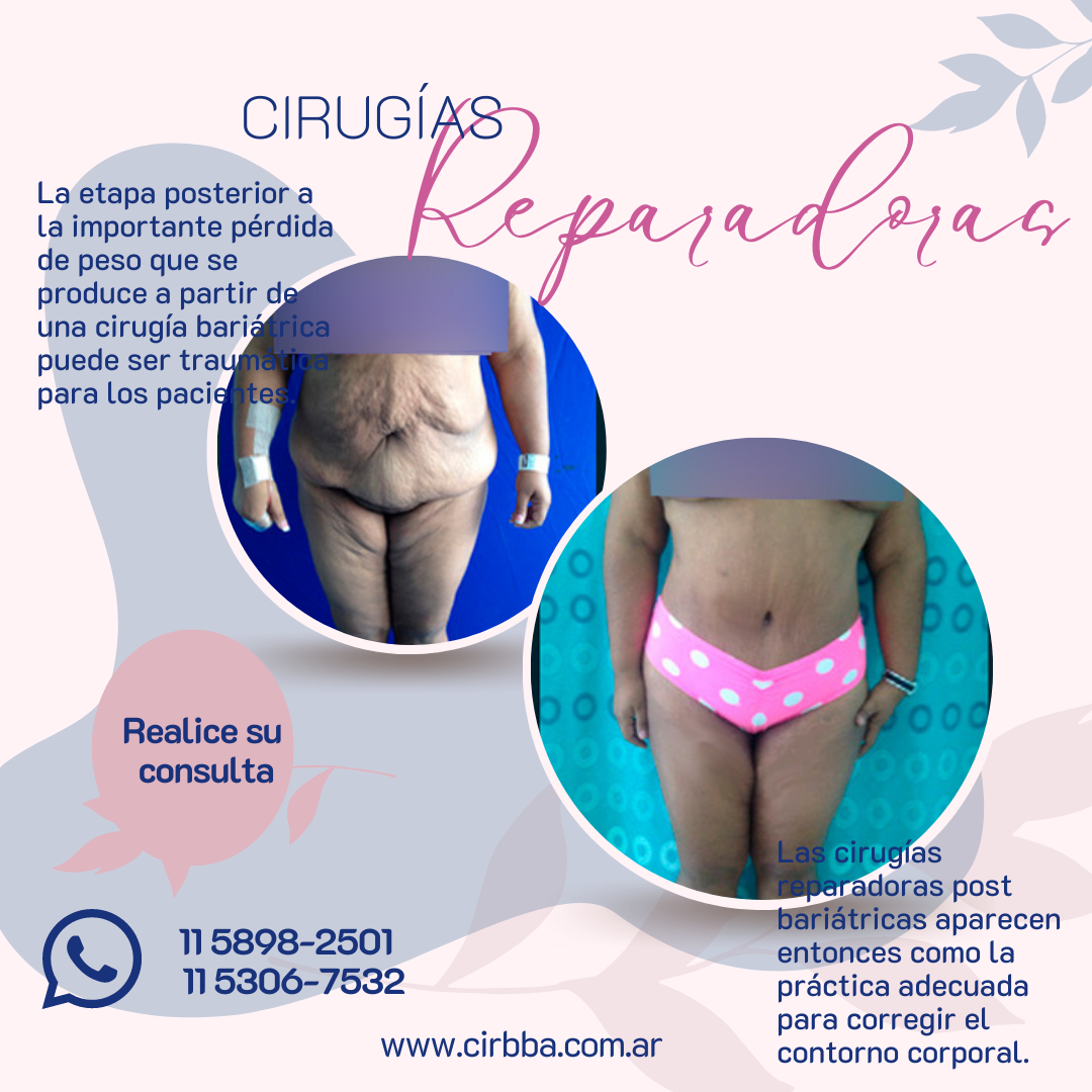 Cirugías reparadoras