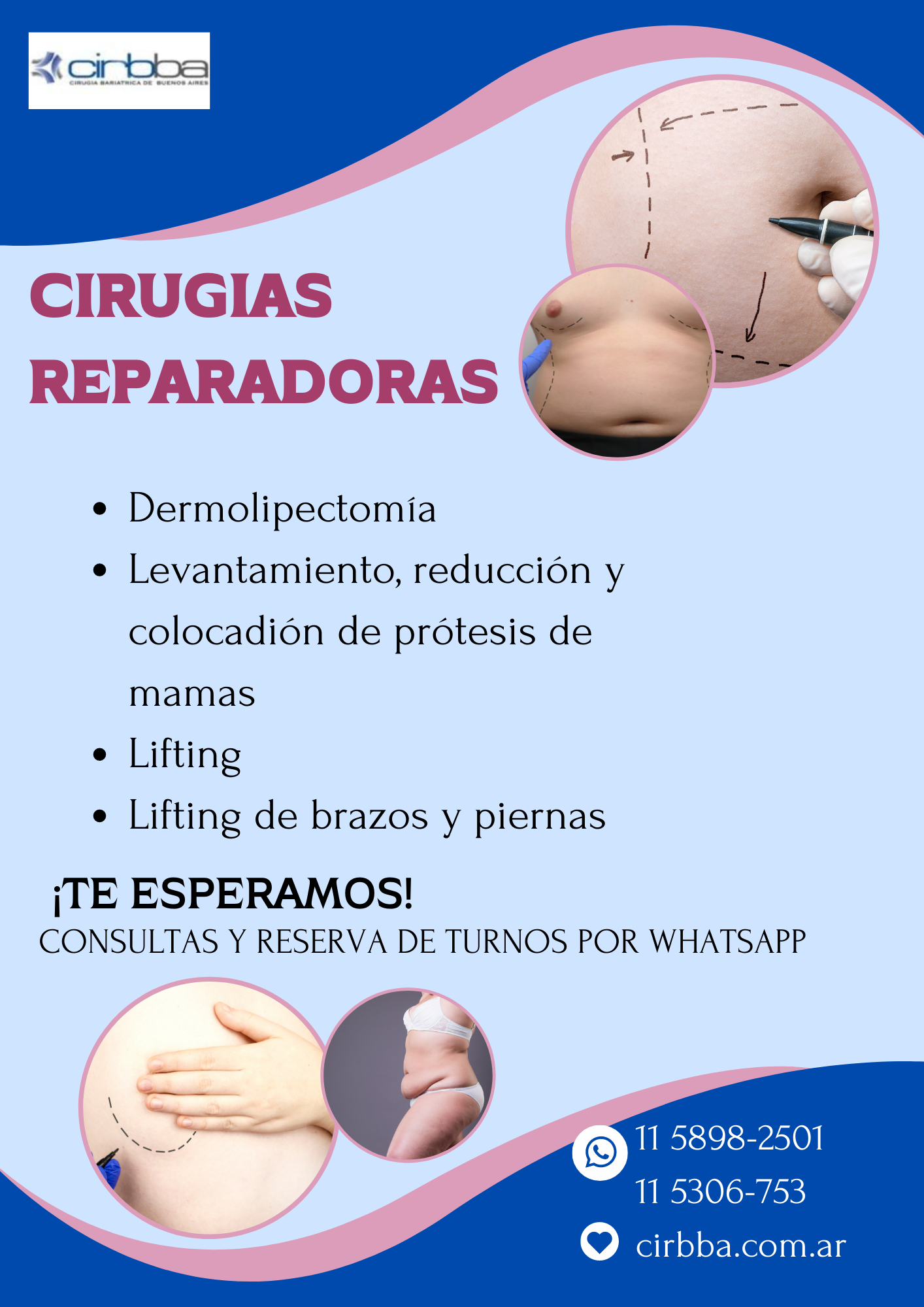 Cirugías reparadoras. Variantes.