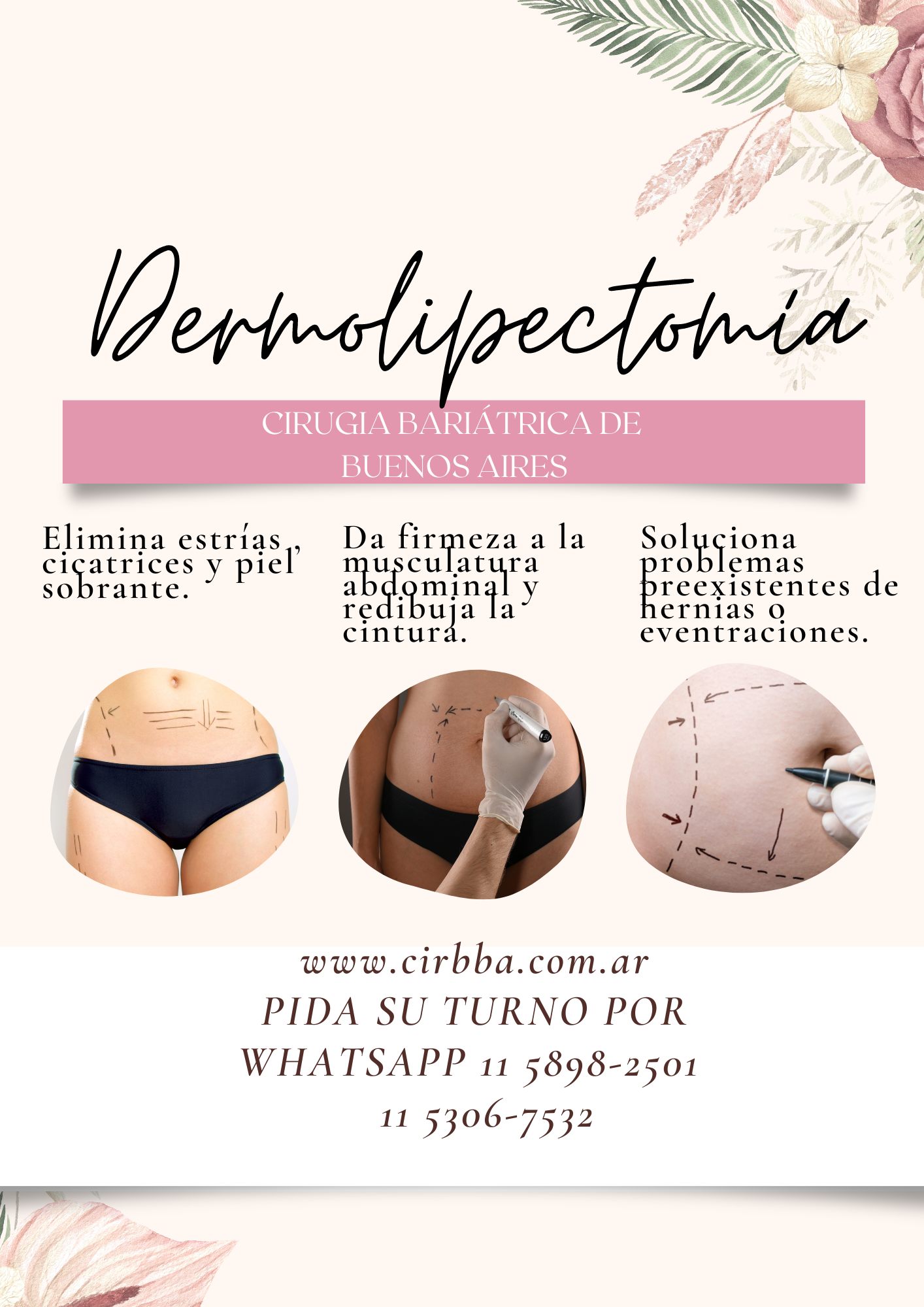Dermolipectomía