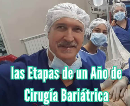 Las etapas de un año de cirugía bariátrica