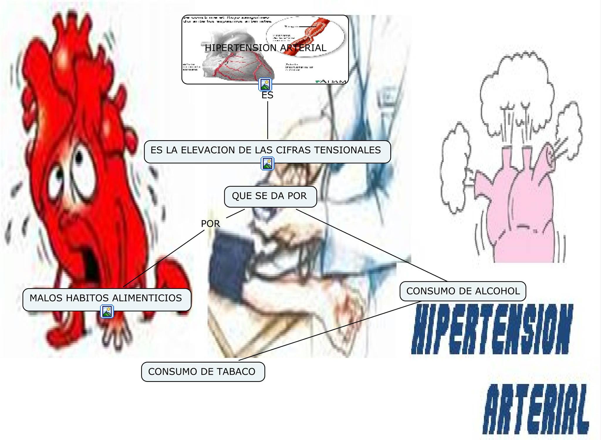 Qué es la hipertensión arterial?