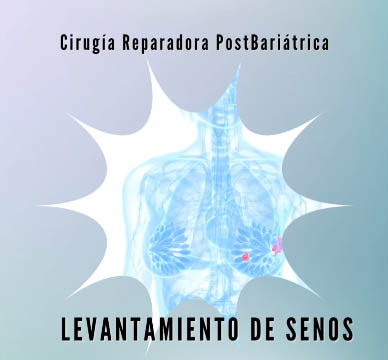 Levantamiento de senos