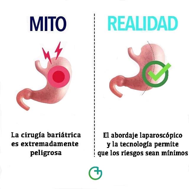 Mitos sobre la cirugía bariátrica