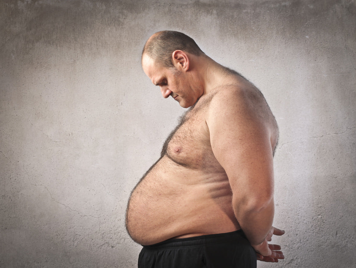 La obesidad como factor incapacitante