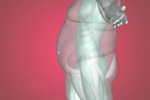 Obesidad: prevención