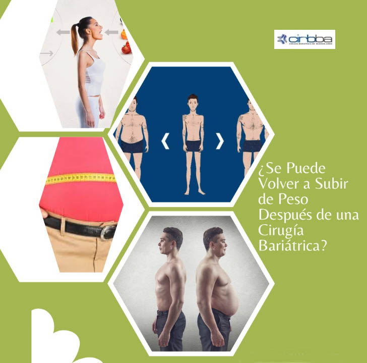 Se puede volver a subir de peso después de una cirugía bariátrica?